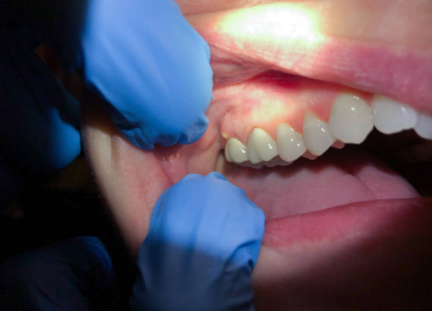 Best Knocked-Out Tooth Emergency  in , SD